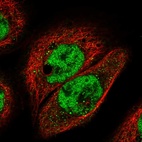 Immunofluorescent staining of human cell line A-431 shows localization to nucleoplasm.
