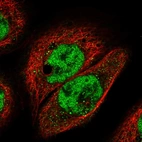 Immunofluorescent staining of human cell line A-431 shows localization to nucleoplasm.