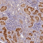 Anti-HYKK Antibody