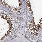 Anti-KCTD4 Antibody