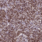 Anti-TRAF3IP3 Antibody