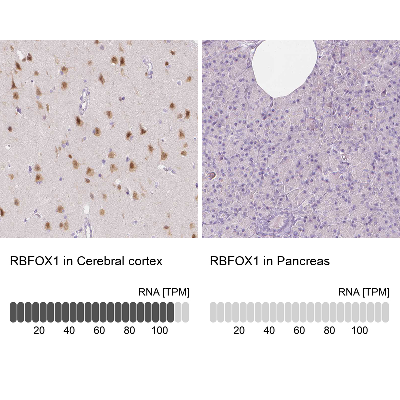 Anti-RBFOX1 Antibody