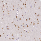 Immunohistochemical staining of human cerebral cortex shows strong nuclear positivity in neurons.
