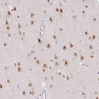 Immunohistochemical staining of human cerebral cortex shows strong nuclear positivity in neurons.