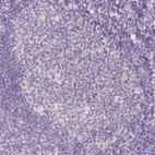 Immunohistochemical staining of human tonsil shows no nuclear positivity in germinal center cells as expected.
