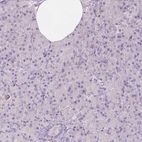 Immunohistochemical staining of human pancreas shows no positivity in exocrine glandular cells as expected.