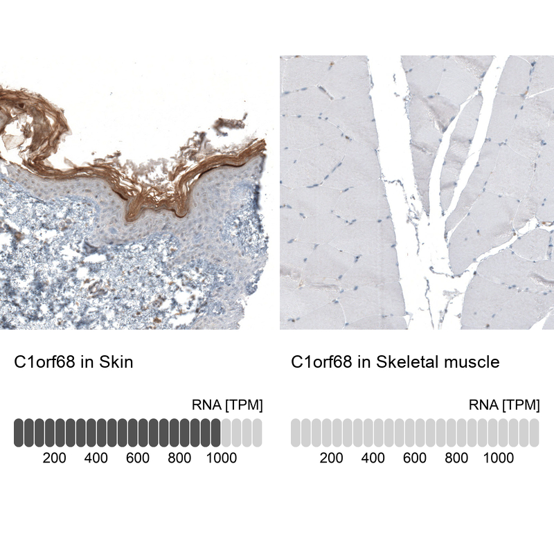 Anti-C1orf68 Antibody