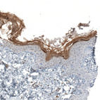 Immunohistochemical staining of human skin shows moderate positivity in stratum corneum and granular layer of epidermis.
