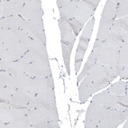 Immunohistochemical staining of human skeletal muscle shows no positivity as expected.