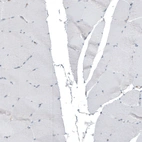 Immunohistochemical staining of human skeletal muscle shows no positivity as expected.