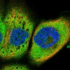 Immunofluorescent staining of human cell line A-431 shows localization to cytosol.