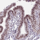 Immunohistochemical staining of human fallopian tube shows moderate nuclear positivity in glandular cells.