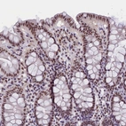 Immunohistochemical staining of human colon shows moderate to strong nuclear positivity in glandular cells.