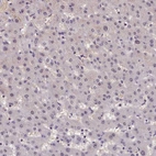 Immunohistochemical staining of human liver shows no positivity in hepatocytes as expected.
