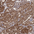 Immunohistochemical staining of human kidney shows moderate cytoplasmic positivity in cells in tubules.
