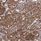 Immunohistochemical staining of human kidney shows moderate cytoplasmic positivity in cells in tubules.