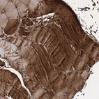 Immunohistochemical staining of human skeletal muscle shows strong cytoplasmic positivity in myocytes.