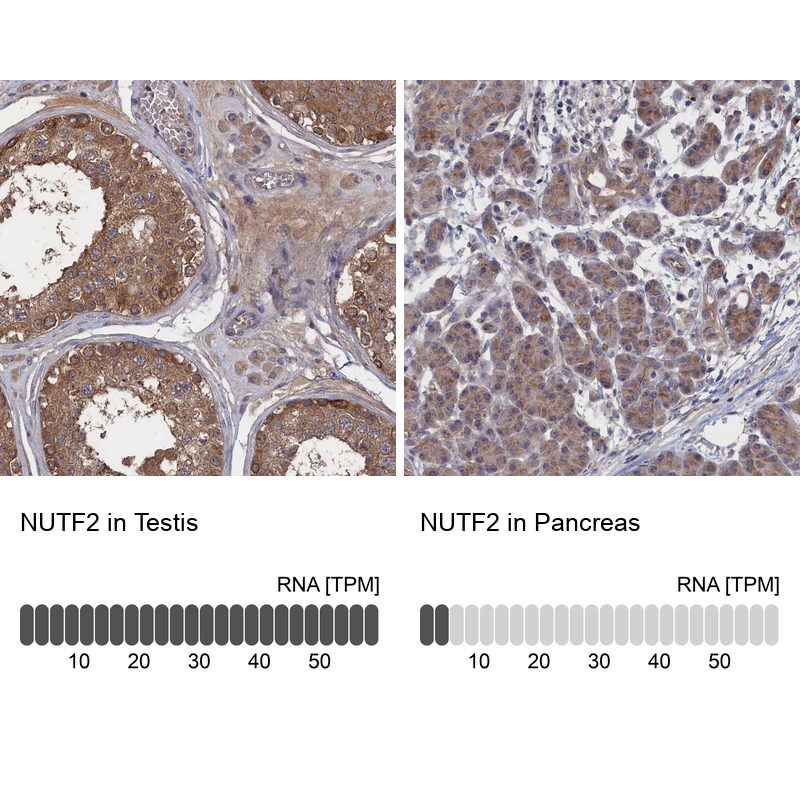 Anti-NUTF2 Antibody