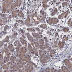 Immunohistochemical staining of human pancreas shows low expression as expected.