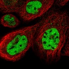Immunofluorescent staining of human cell line A-431 shows localization to nucleoplasm.