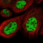 Immunofluorescent staining of human cell line A-431 shows localization to nucleoplasm.