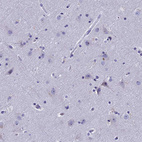 Anti-KNOP1 Antibody