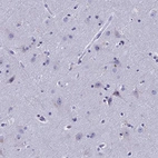 Anti-KNOP1 Antibody