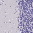 Immunohistochemical staining of human cerebellum shows strong positivity in nucleoli in Purkinje cells.