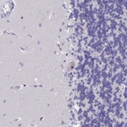 Immunohistochemical staining of human cerebellum shows strong positivity in nucleoli in Purkinje cells.