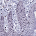 Immunohistochemical staining of human skin shows strong positivity in nucleoli in squamous epithelial cells.