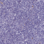 Immunohistochemical staining of human tonsil shows no positivity in non-germinal center cells as expected.