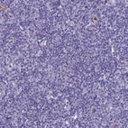 Immunohistochemical staining of human tonsil shows no positivity in non-germinal center cells as expected.