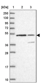 Lane 1: Marker [kDa] 250, 130, 95, 72, 55, 36, 28, 17, 10_br/_Lane 2: Human cell line RT-4_br/_Lane 3: Human cell line U-251MG sp