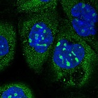 Immunofluorescent staining of human cell line A-431 shows localization to nucleoli & cytosol.