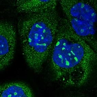 Immunofluorescent staining of human cell line A-431 shows localization to nucleoli & cytosol.