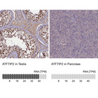 Anti-ATF7IP2 Antibody