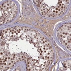 Immunohistochemical staining of human testis shows high expression.