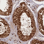 Immunohistochemical staining of human testis shows strong nuclear positivity in cells in seminiferous ducts.