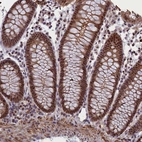 Immunohistochemical staining of human colon shows strong nuclear positivity in glandular cells.