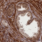 Immunohistochemical staining of human prostate shows strong nuclear positivity in glandular cells.