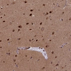 Immunohistochemical staining of human cerebral cortex shows strong nuclear positivity in neurons.
