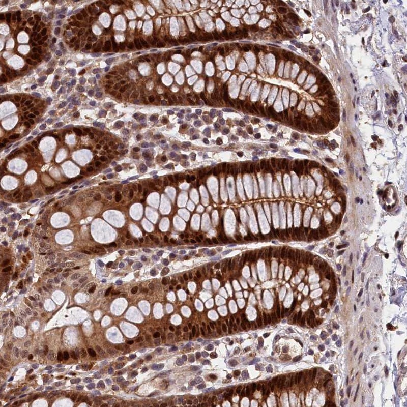 Anti-C16orf70 Antibody