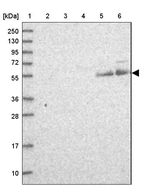 Lane 1: Marker [kDa] 250, 130, 95, 72, 55, 36, 28, 17, 10_br/_Lane 2: Human cell line RT-4_br/_Lane 3: Human cell line U-251MG sp_br/_Lane 4: Human plasma (IgG/HSA depleted)_br/_Lane 5: Human liver tissue_br/_Lane 6: Human tonsil tissue