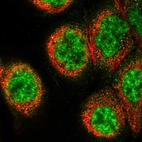 Immunofluorescent staining of human cell line A-431 shows localization to nuclear speckles & cytosol.