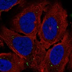 Anti-ADCY7 Antibody