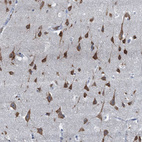 Immunohistochemical staining of human cerebral cortex shows strong cytoplasmic positivity in neurons.