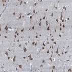 Immunohistochemical staining of human cerebral cortex shows strong cytoplasmic positivity in neurons.