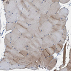 Immunohistochemical staining of human skeletal muscle shows weak cytoplasmic positivity in myocytes.