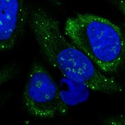 Immunofluorescent staining of human cell line U-2 OS shows localization to nucleoli fibrillar center & vesicles.