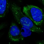 Immunofluorescent staining of human cell line U-2 OS shows localization to nucleoli fibrillar center & vesicles.
